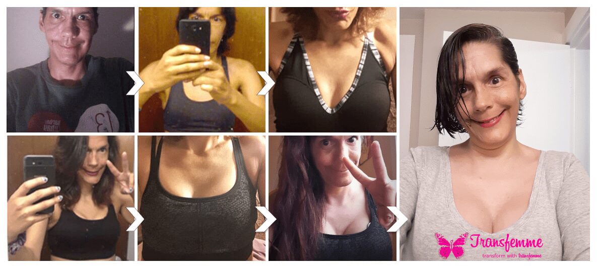 Transfemme customer for breast enlargement