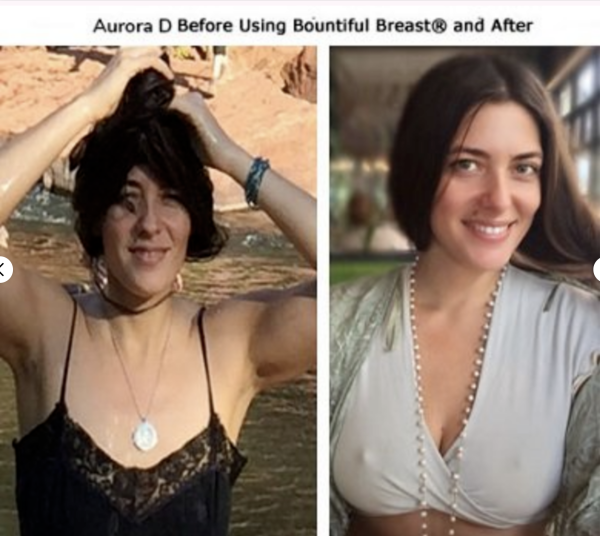 Aurora D before and after using bountiful breast cream