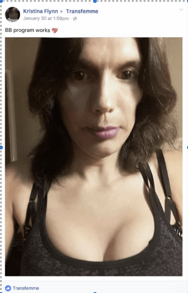 Transfemme® Breast Cream for transwoman