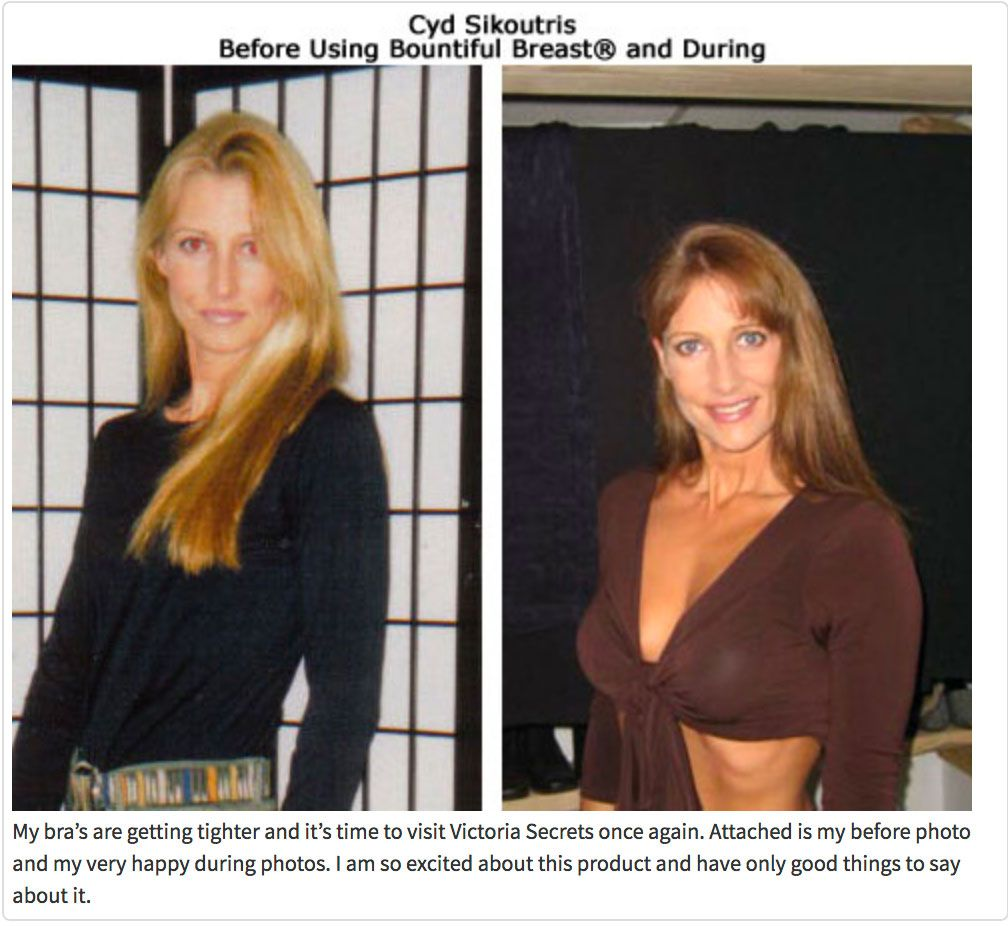 Cyd Sikoutris before using bountiful breast cream and during
