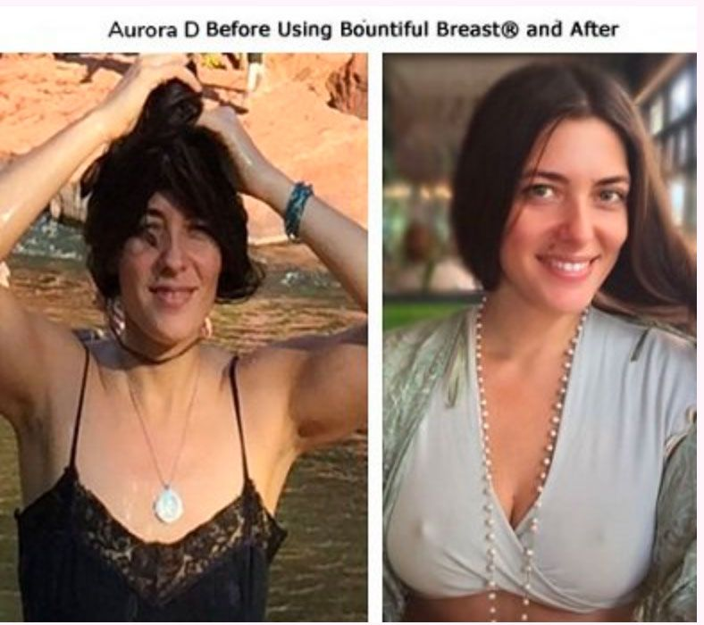 Breasts-Shape-Up after and before